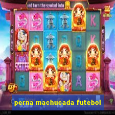 perna machucada futebol