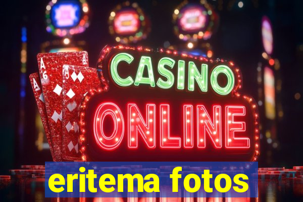 eritema fotos