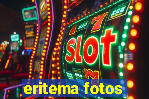 eritema fotos